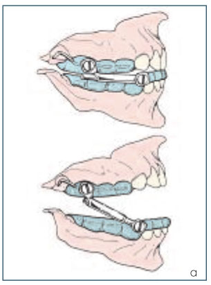Illustrazione 1 - Odontoiatria