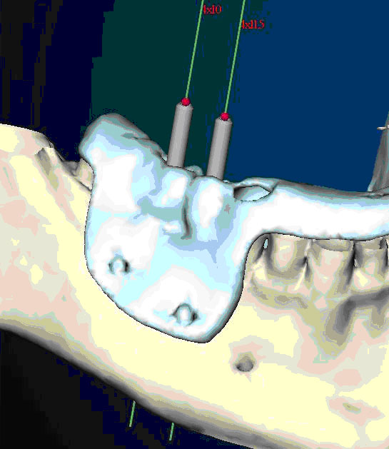 Illustrazione 1 - Odontoiatria