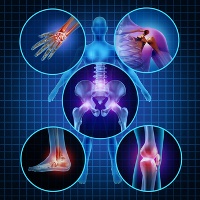 I sintomi dell’osteoporosi