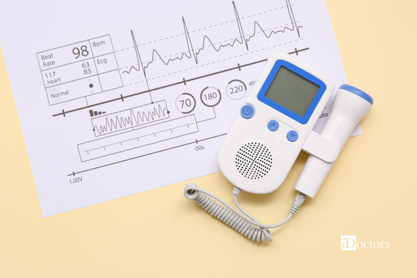 Ecografo bianco e blu davanti a un tracciato di un'ecocolordoppler.