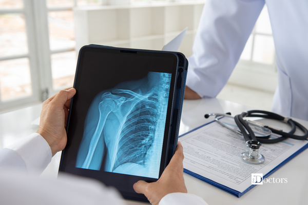 Mani di un medico con in mano un tablet che mostra una rx alla spalla.