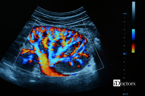 Immagine ecografica con EcoColorDoppler che evidenzia il flusso sanguigno nei vasi