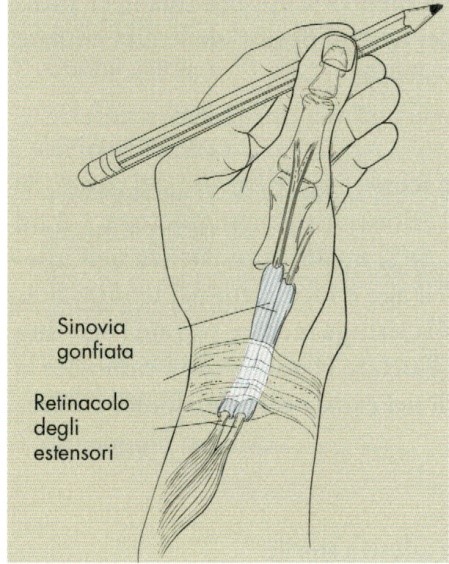 Illustrazione 1 - Ortopedia e Traumatologia