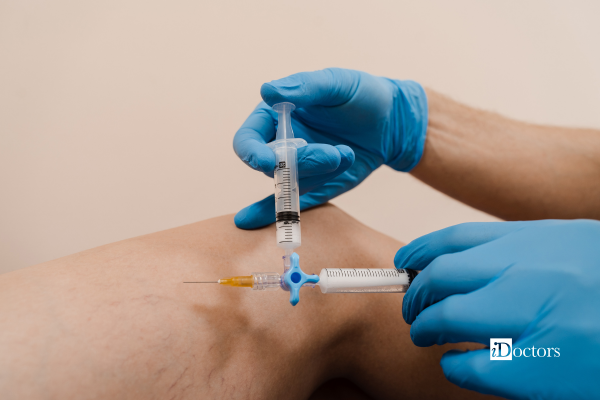 Scleroterapia delle vene varicose eseguita mediante iniezione di una sostanza sclerosante nella gamba.