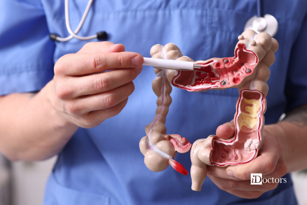 Medico che tiene in mano una penna e indica il modellino dell'intestino.