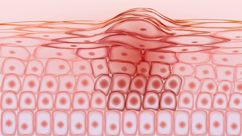 Illustrazione 4 - Dermatologia e Venereologia