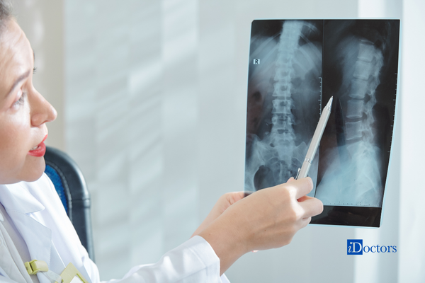 Dottoressa con in mano una penna che indica e guarda una rx alla colonna.