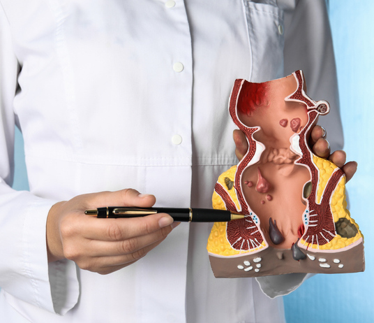 Illustrazione 1 - Chirurgia Proctologica e Proctologia