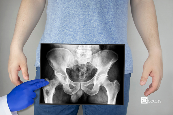 Mano del medico che tiene un'rx dell'anca davanti all'anca del paziente.