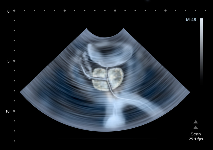 Illustrazione 1 - Radiologia TAC e Risonanza