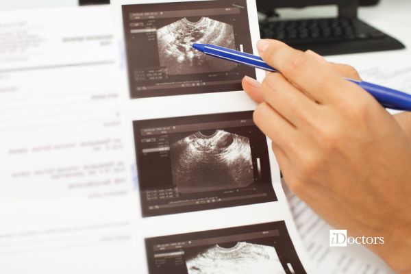 Medico indica con una penna le immagini ecografiche del monitoraggio follicolare.