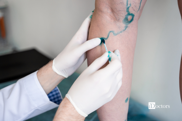 Medico che sta evidenziando con del colore le vene della gamba di una paziente.