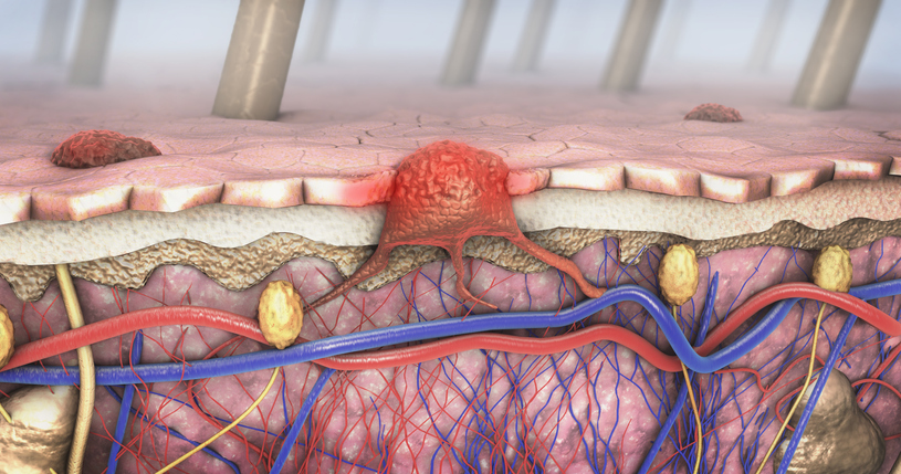 Illustrazione 5 - Dermatologia e Venereologia