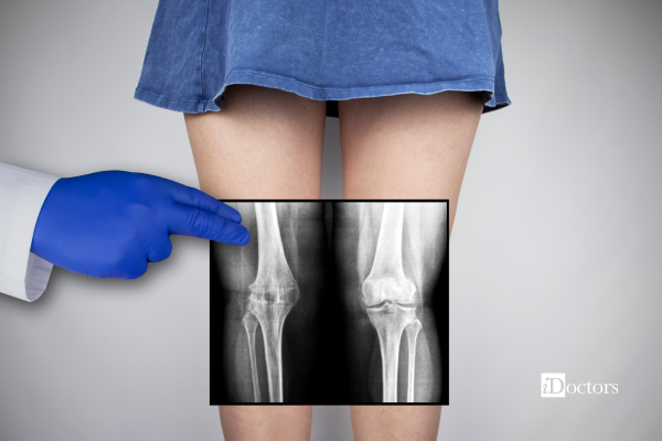 medico che tiene in mano una rx al ginocchio davanti alle ginocchia della paziente