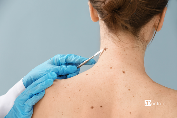 Mano di un medico con un bisturi appoggiato alla schiena di una paziente.