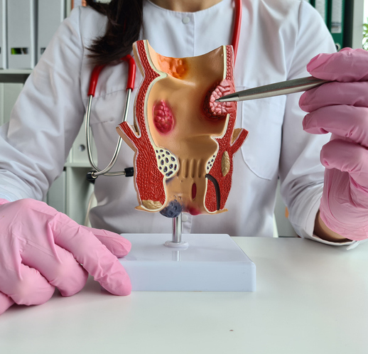 Illustrazione 1 - Chirurgia Proctologica e Proctologia