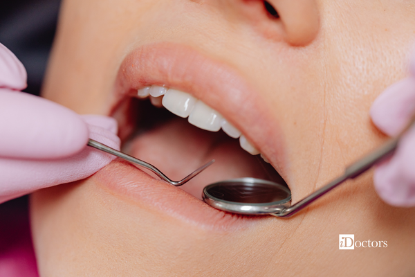 Bocca aperta di una paziente che sta effettuando la pulizia dei denti.