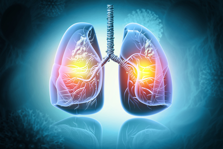 Illustrazione 1 - Pneumologia e Malattie Respiratorie
