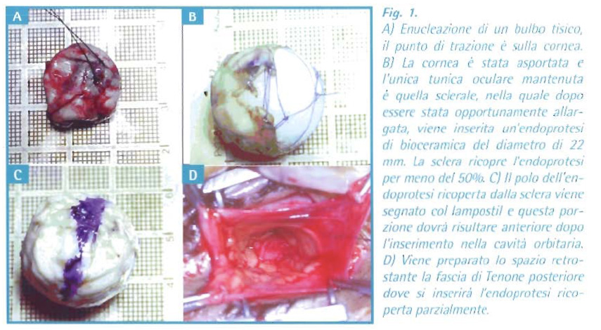 Illustrazione 2 - Oculistica