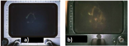 persistenza del pattern sanguigno per lungo tempo
