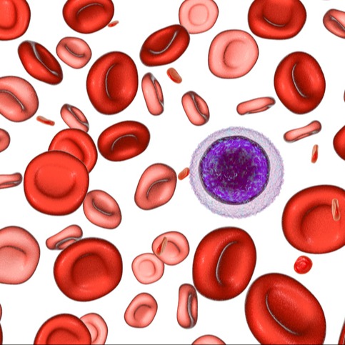 Anemia mediterranea (talassemia)