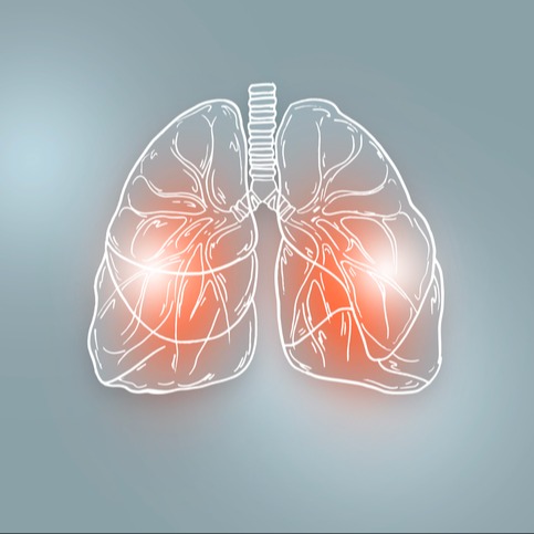 enfisema polmonare