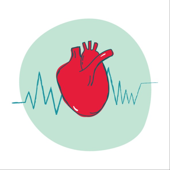 Cardiopatia ischemica