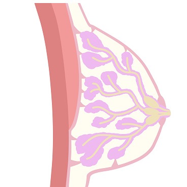 Ectasia duttale