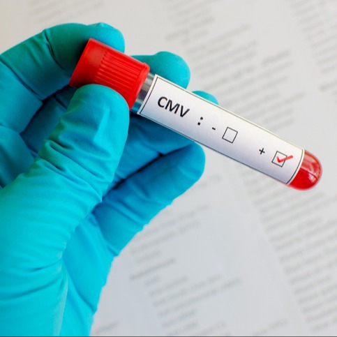 Infezione da Cytomegalovirus (CMV)