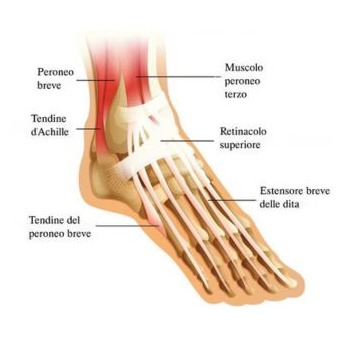 Infiammazione tendine d'Achille