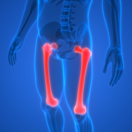 Osteopetrosi